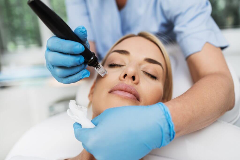 Microneedling Vs RF Microneedling
