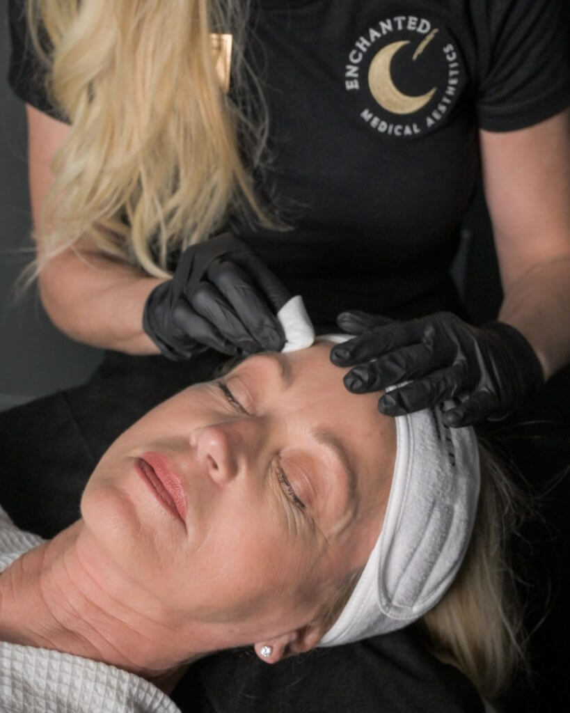 Chemical Peels Treatment in Ormond Beach, FL