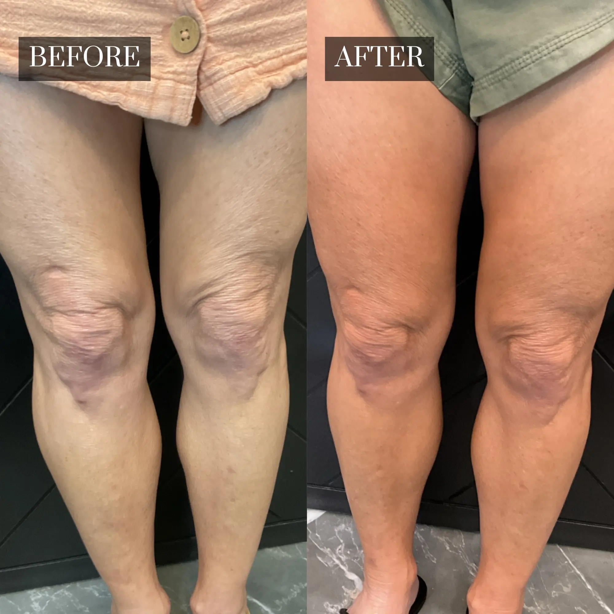 Before & After